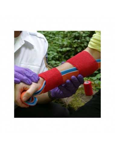 SAM SPLINT Tala Moldável após aplicação