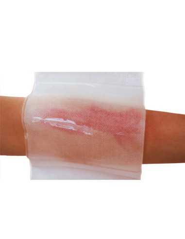 BURNTEC - Curativo Hidrogel para Queimaduras